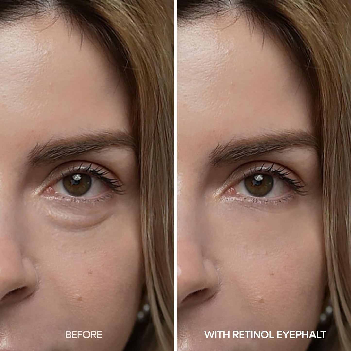 Retinol Eyebag Cream for Puffiness, Dark Circles & Fine Lines, Wrinkle, EGF Anti-Aging Under Eye Moisturizer with Niacinamide&Ceramide Makeup friendly korean skin care