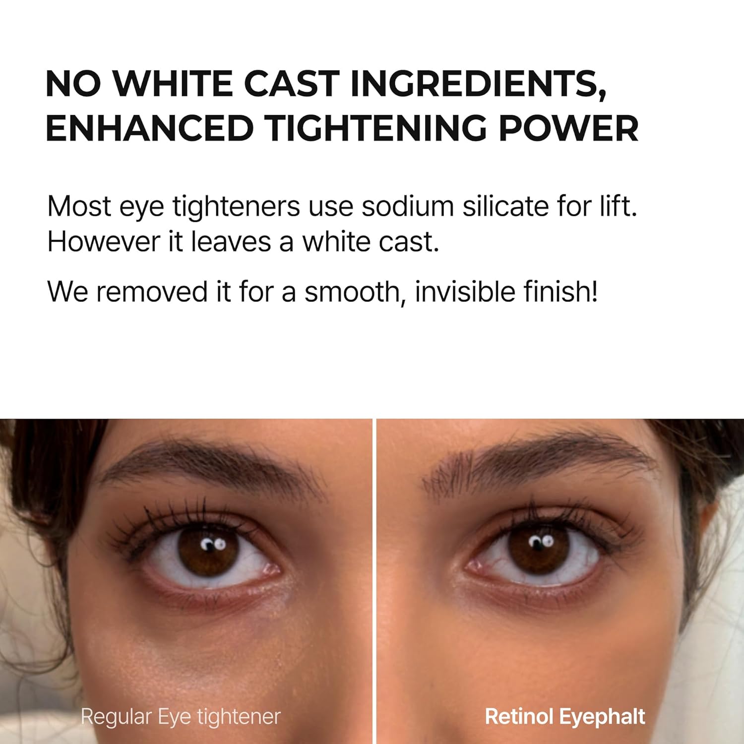 Retinol Eyebag Cream for Puffiness, Dark Circles & Fine Lines, Wrinkle, EGF Anti-Aging Under Eye Moisturizer with Niacinamide&Ceramide Makeup friendly korean skin care