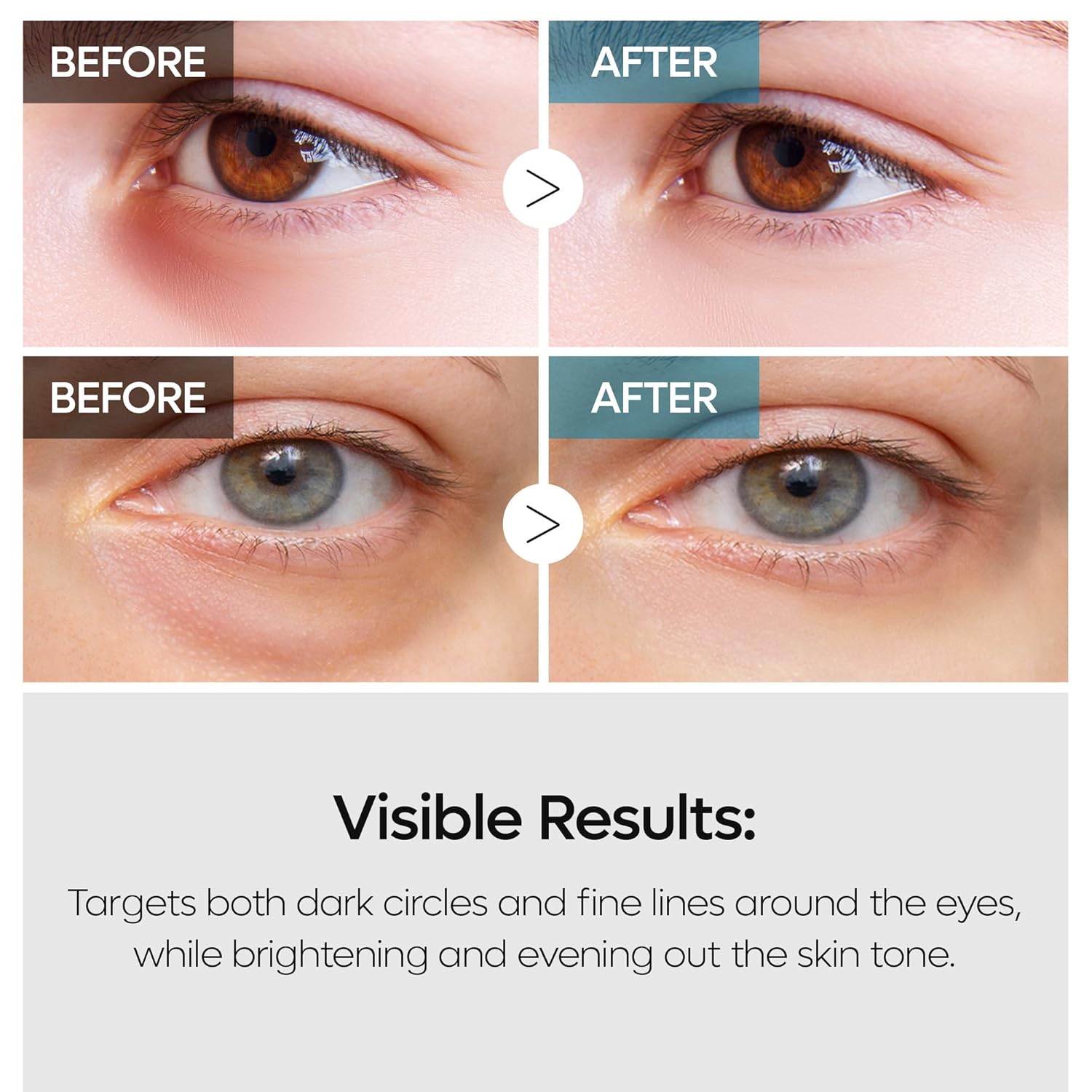 TX Tranexamic Acid Retinalsome Dual Eye Cream with Adenosine Niacinamide for Dark circle Repairing | Daily Anti-Aging Under Eye Care | 50ml - Korean Skin care